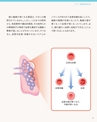 肺高血圧症を知る