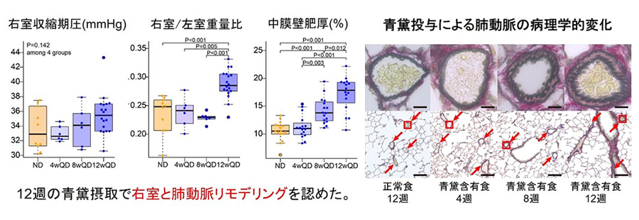 左図：12週の青黛摂取で右室と肺動脈リモデリングを認めた。右図：青黛投与による肺動脈の病理学的変化