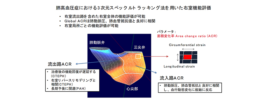 肺高血圧症における3次元スペックルトラッキング法を用いた右室機能評価